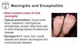 5 Enterovirus clinical manifestations including poliore [upl. by Adamina]