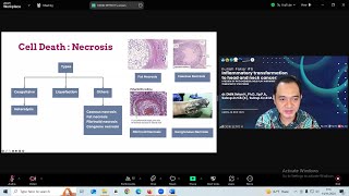 FKG UNEJ Kuliah Pakar Series VIII  Inflammatory Tranformasi to Head and Neck Cancer [upl. by Graig538]