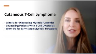 CTCL Criteria to Diagnose Counsel Patients and WorkUp for Earlystage Mycosis Fungoides [upl. by Ahkihs]