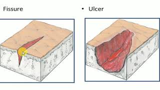 Dermatology PRIMARY and SECONDARY SKIN LESION [upl. by Sakovich951]