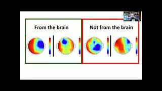 Criteria for Identifying Interictal Epileptiform Discharges Sándor Beniczky CairoNeuro 2022 [upl. by Spear]