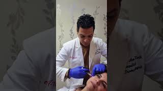 Profhilo 5 injection points 💉 Amazing quick amp effective بروفايلو ٥ نقاط للحقن  روعة و سريع [upl. by Kcirttap]