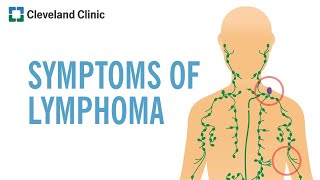 Warning Signs of Lymphoma [upl. by Azirb]