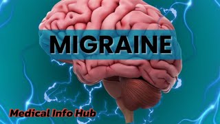 Migraine Headache Relief Migraine ka ilaj Migraine symptoms Migraine painMigraine [upl. by Nonnel483]