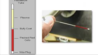 How to Measure the Hematocrit  physio lab practical [upl. by Mccollum]