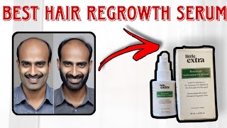 Little Extra Hair Regrowth Serum Review Ghane Baalon ka Raaz 💆‍♀️ hair regrowth littleextraserum [upl. by Allemap]