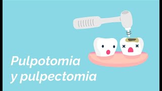 Diferencia entre pulpotomia u pulpectomia [upl. by Seth203]