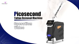 Picosecond Tattoo Removal Machine Operation Video [upl. by Marala408]