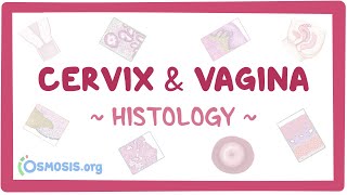 Cervix and vagina Histology [upl. by Horatius868]