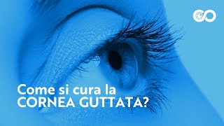 Come si cura la cornea guttata [upl. by English]