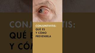 👀 Todo sobre la Conjuntivitis síntomas causas y tratamientos efectivos  Ojo rojo y cuidado ocular [upl. by Einohpets668]