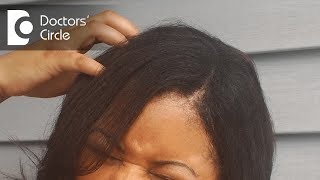 Reasons for itchy scalp and how to treat it  Dr Rasya Dixit [upl. by Nika]