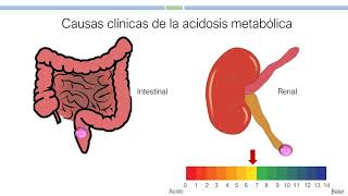 3 Alteraciones del equilibrio ácidobase Bioquímica Parte 1 [upl. by Qidas725]