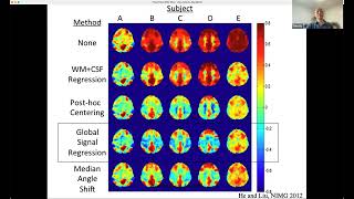 Multimodal Imaging and RestingState Global Brain Activity Controversies Hypotheses and Discovery [upl. by Donoho912]