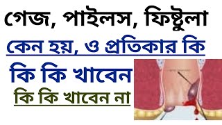 গ্যাজ রোগের চিকিৎসা । piles treatmenthemorrhoids treatmentpiles treatment at homepiles problem [upl. by Rapp634]