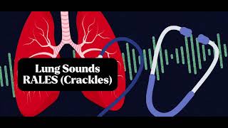 Understanding Rales Crackles Lung Sounds Accurate Lung Assessment [upl. by Oivat]