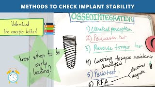 osseointegration of dental implants  final part [upl. by Godric21]