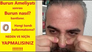 Burun ameliyatı sonrası burun bantlama nasıl yapılır Rinoplasti sonrası [upl. by Kort476]