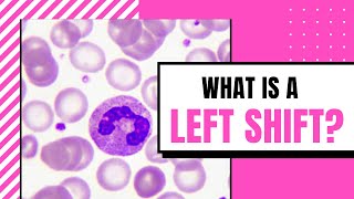 What is a Left ShiftHematology [upl. by Cohn]