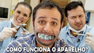 Como o aparelho desentorta os dentes Boravê [upl. by Yerbua]