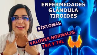 ¿Puedo saber si tengo problemas de tiroides sin ir al médico VALORES NORMALES DE TSH Y T4L [upl. by Ramoj]