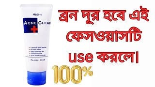 Mistine Acne Clear Facial Foam Face WashMistine Acne Clear Face Wash reviewhow to useBangla [upl. by Mcclimans308]