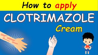 Clotrimazole cream Lotrimin How to apply  Uses and Side effects [upl. by Gelhar]