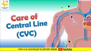 Care of Central Venous Catheter  Care of Central Line  Central line amp Nursing considerations [upl. by Chaves]