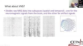 CETNCLAE Grand Rounds September 21 2024 MEG in Clinical Practice Professor Mohammed [upl. by Arlinda]