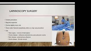 The Role of Surgery in Fertility Management [upl. by Shiau360]