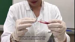 MENSURAÇÃO DO HEMATÓCRITO E PROTEÍNAS PLASMÁTICAS [upl. by Xad166]