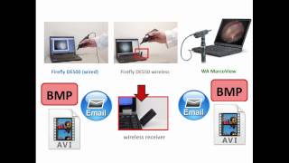 Video Otoscope Comparison [upl. by Marutani79]