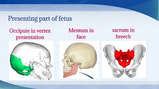 Malposition  Definition Etiology Diagnosis Management of malposition  Easy explanation OBGY Nsg [upl. by Inga]