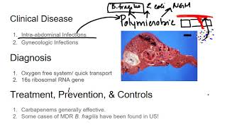 Gram Negative Rods Bacteroidies fragilis [upl. by Aryn]