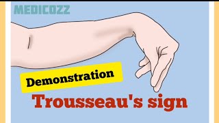 Trousseaus sign in Hypocalcemia  Patient video  causes treatment prevention [upl. by Leora]