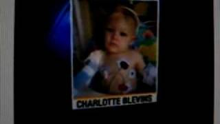 Pit bull attacks 15monthold Charlotte Blevins [upl. by Merlin]