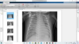 How to resize multiple images in Matlab  Image batch processor [upl. by Liw]