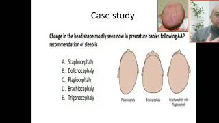 Case 59 AAP Recommendations of sleep in premature babies abnormal head shapes [upl. by Anirod]