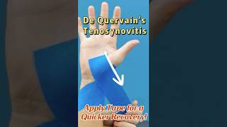 De Quervains Tenosynovitis Tape For INSTANT relief thumbpain wristpain kinesiotape [upl. by Frederique]