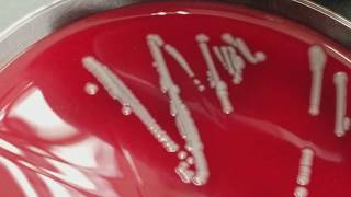 Microbiology Normal flora versus Pathogens [upl. by Borroff]