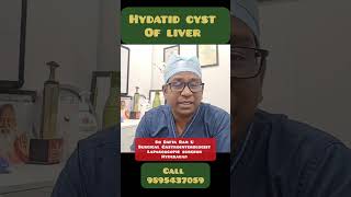 Large liver cysts Hydatid cyst of liver  Liver infection [upl. by Marchal445]