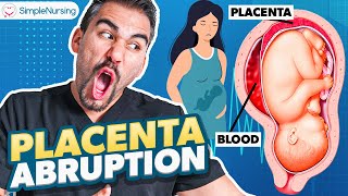 Placental Abruption Symptoms Causes Nursing Interventions  NCLEX Tips [upl. by Ranitta]