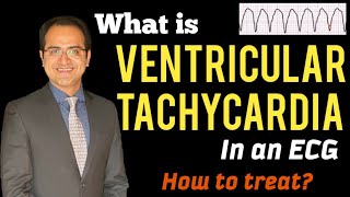 Ventricular Tachycardia VT ECG Interpretation Treatment ACLS Management Lectures USMLE NCLEX [upl. by Kcirttap788]