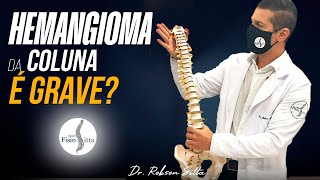 HEMANGIOMA DA COLUNA VERTEBRAL TEM CURA  Clínica Dr Robson Sitta [upl. by Hett]