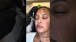 Natural Results Live Here fillersarelife skincare [upl. by Levey]