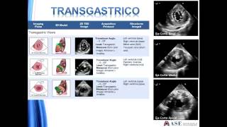 Guias para un examen de echocardiografia transesofagica integral [upl. by Alikam83]