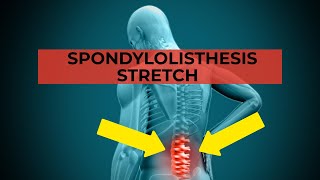 Spondylolisthesis Stretch [upl. by Inram]