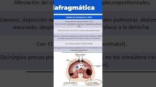 HERNIA DIAFRAGMÁTICA CX PEDIÁTRICA 202425 medstudent medicalreview [upl. by Schacker739]