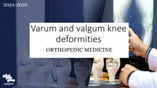 Varum and valgum knee deformities orthopedic medicine Lec 8 part 1 [upl. by Franci574]