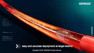 Genoss Peripheral Stent System [upl. by Odele547]